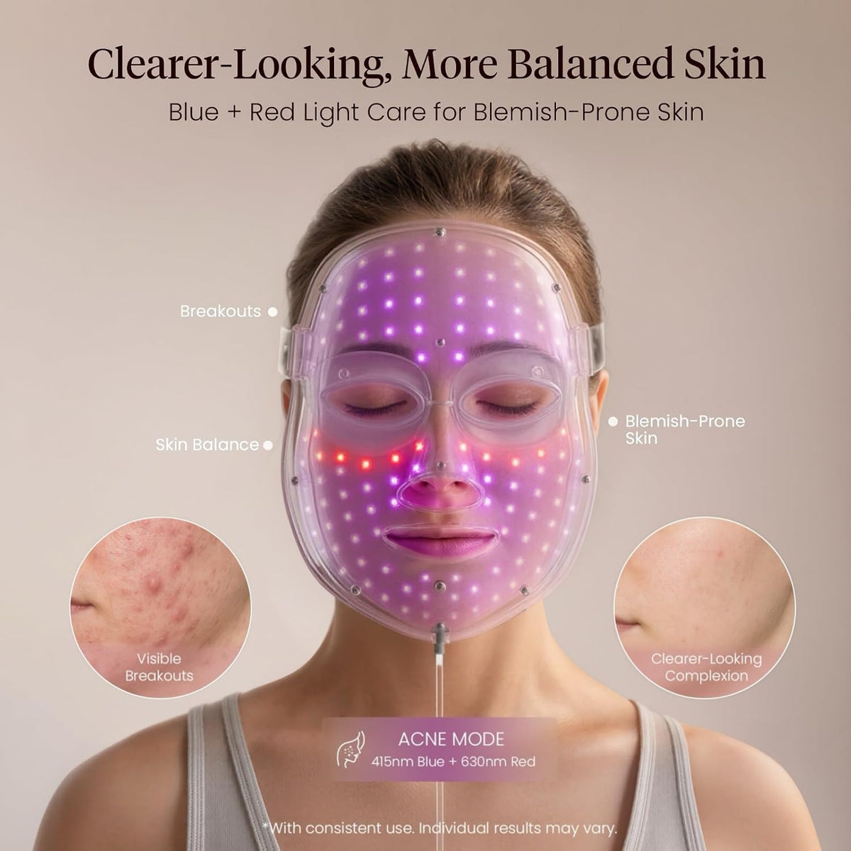 A woman wearing a clear LED light therapy mask that glows with blue and red light, shown against a beige background with text and before/after skin comparison circles.