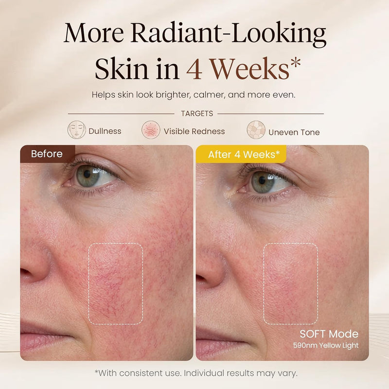 Promotional skincare graphic showing a close-up before-and-after comparison of facial skin on a woman's cheek, with text reading 'More Radiant-Looking Skin in 4 Weeks' and targets for dullness, visible redness, and uneven tone.