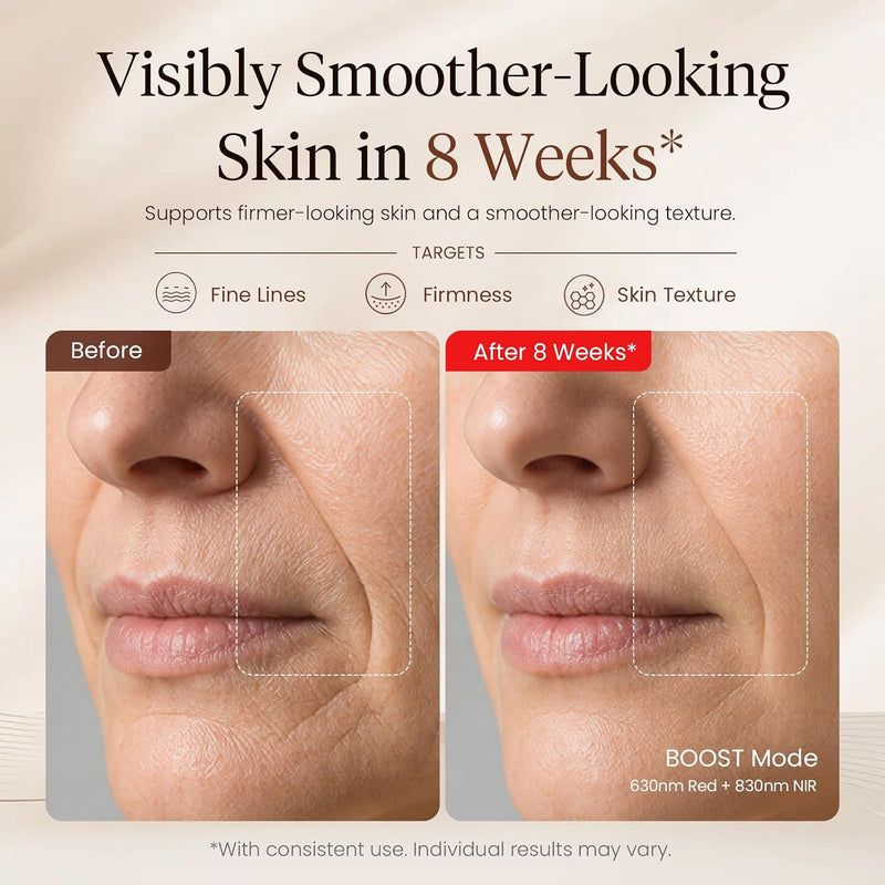 Promotional skincare graphic showing a before-and-after comparison of facial skin on the nose and mouth area, with text reading 'Visibly Smoother-Looking Skin in 8 Weeks' and 'After 8 Weeks' on a beige background.